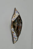 Vulva