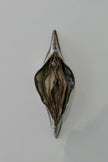 Vulva